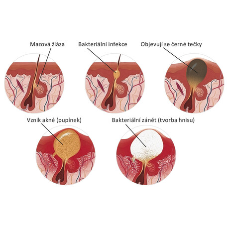 Vakuov isti pleti Vigan Lady THREE