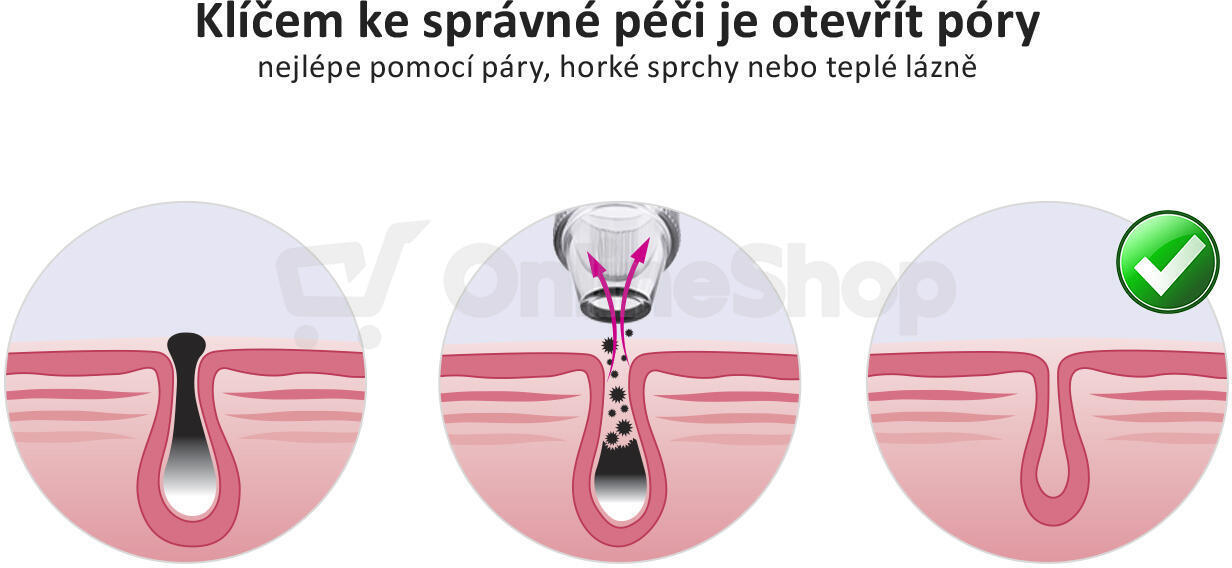 Vakuový čistič pleti Vigan Lady THREE