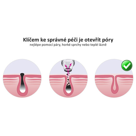 Vakuov isti pleti Vigan Lady THREE