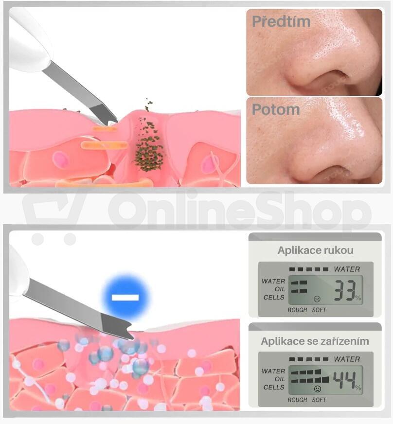 TOUCHBeauty 1887 Ultrazvuková špachtle na pleť